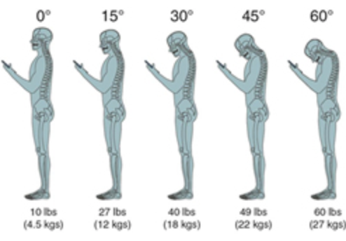 Do you have pain? It could be your posture.